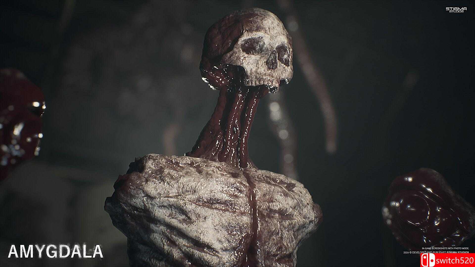 《杏仁核（Amygdala）》集成增强升级 SKIDROW镜像版[EN]_4